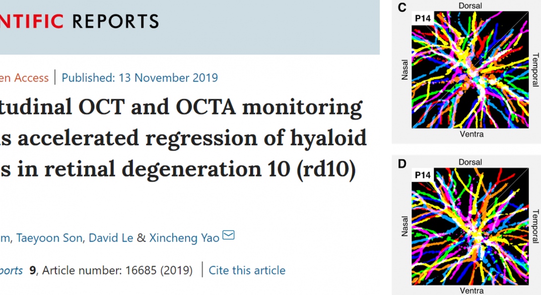 Our new publication in Scientific Reports titled: Longitudinal OCT and OCTA monitoring reveals accelerated regression of hyaloid vessels in retinal degeneration 10 (rd10) mice