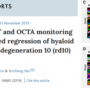 Our new publication in Scientific Reports titled: Longitudinal OCT and OCTA monitoring reveals accelerated regression of hyaloid vessels in retinal degeneration 10 (rd10) mice
                  