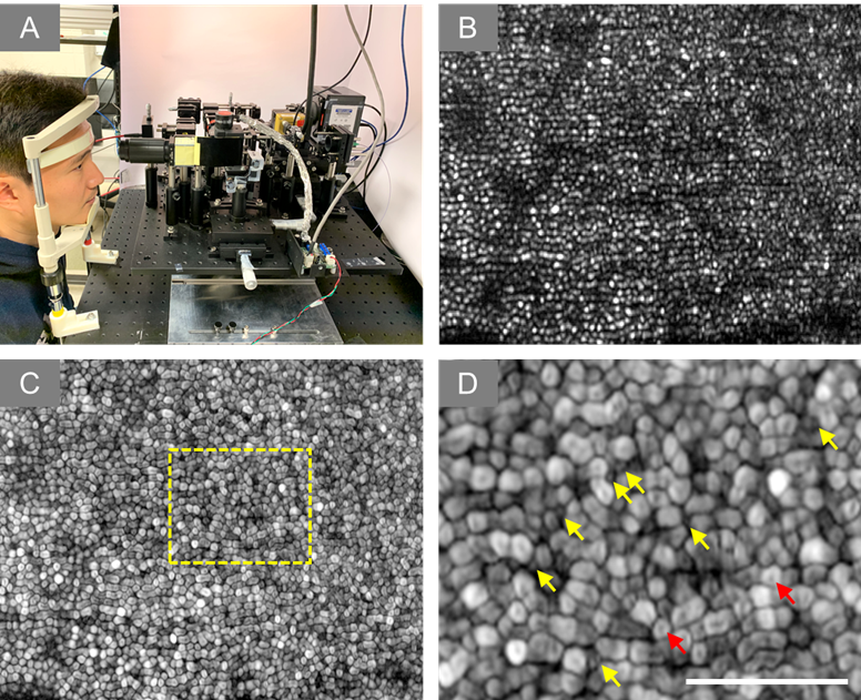 We can use super-resolution microscopy for advanced study and diagnosis of medical diseases.